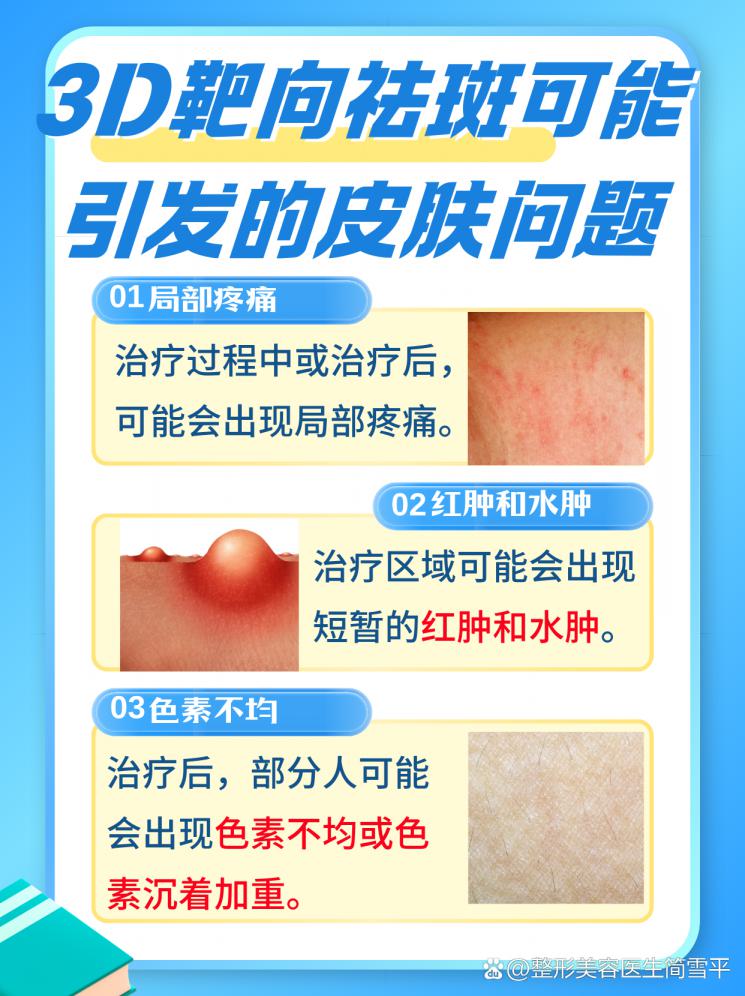 3D靶向祛斑：真的可靠还是美丽陷阱？