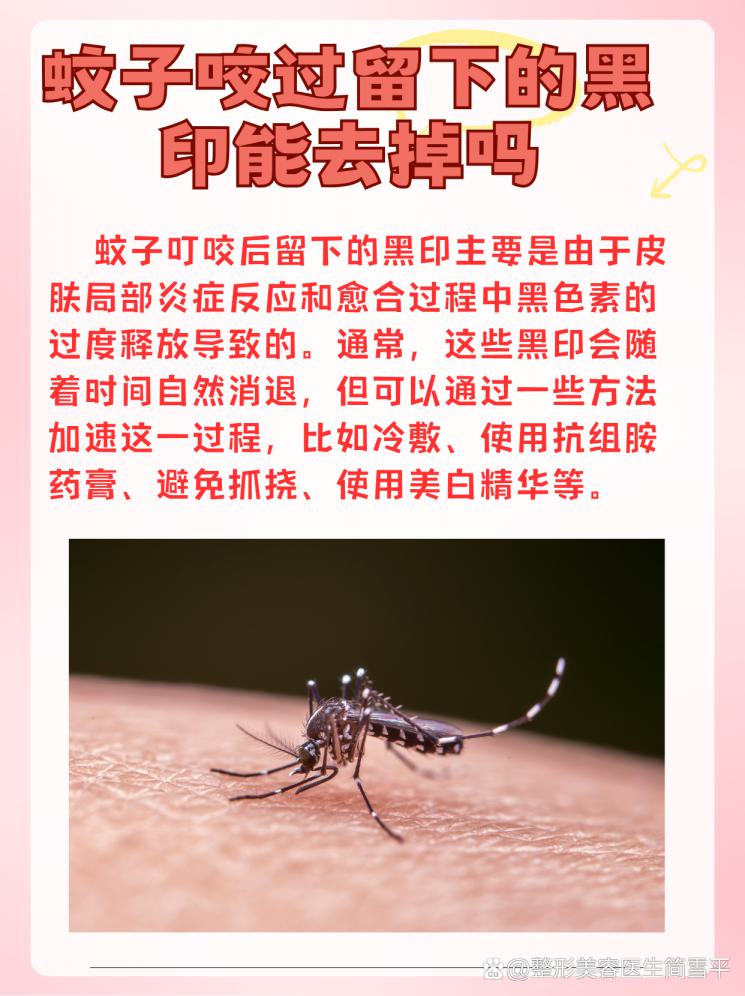 被蚊子咬后留下黑印？皮肤科医生教你轻松应对！