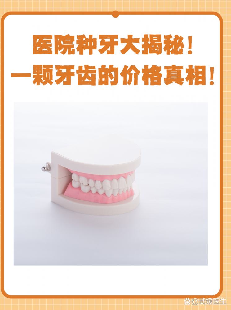 医院种牙大揭秘！一颗牙齿的价格真相！