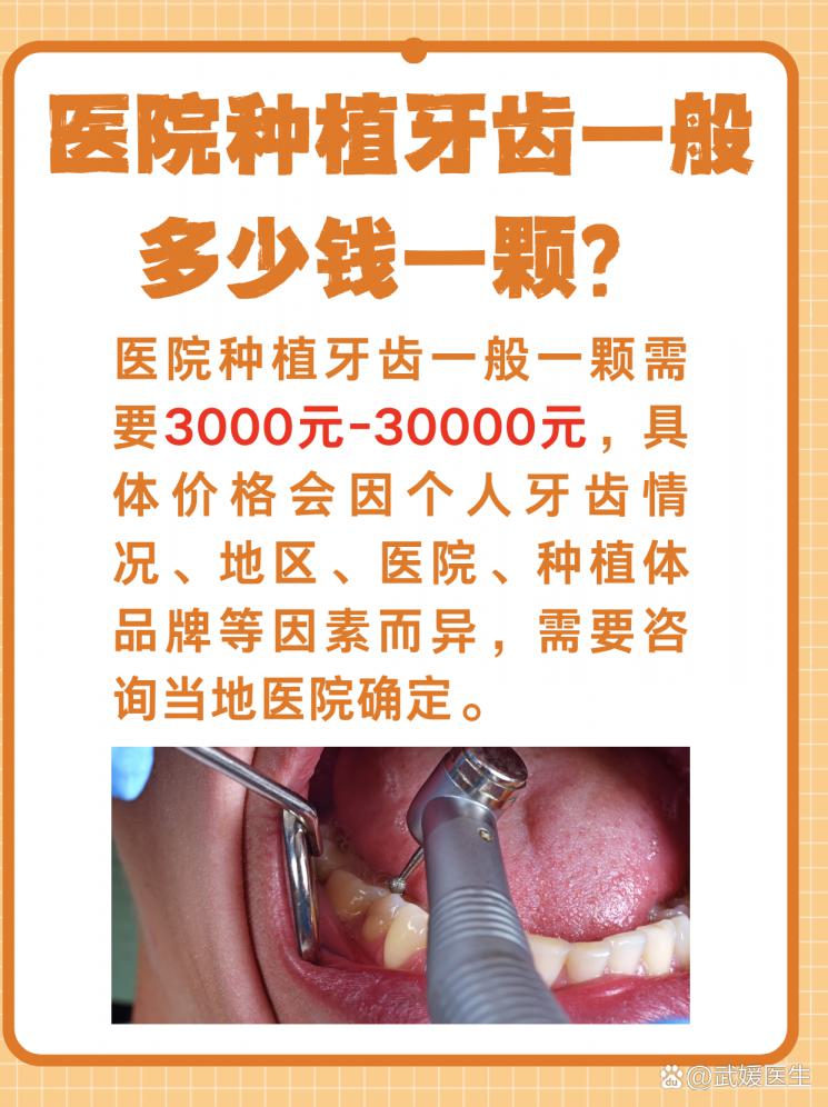医院种牙大揭秘！一颗牙齿的价格真相！