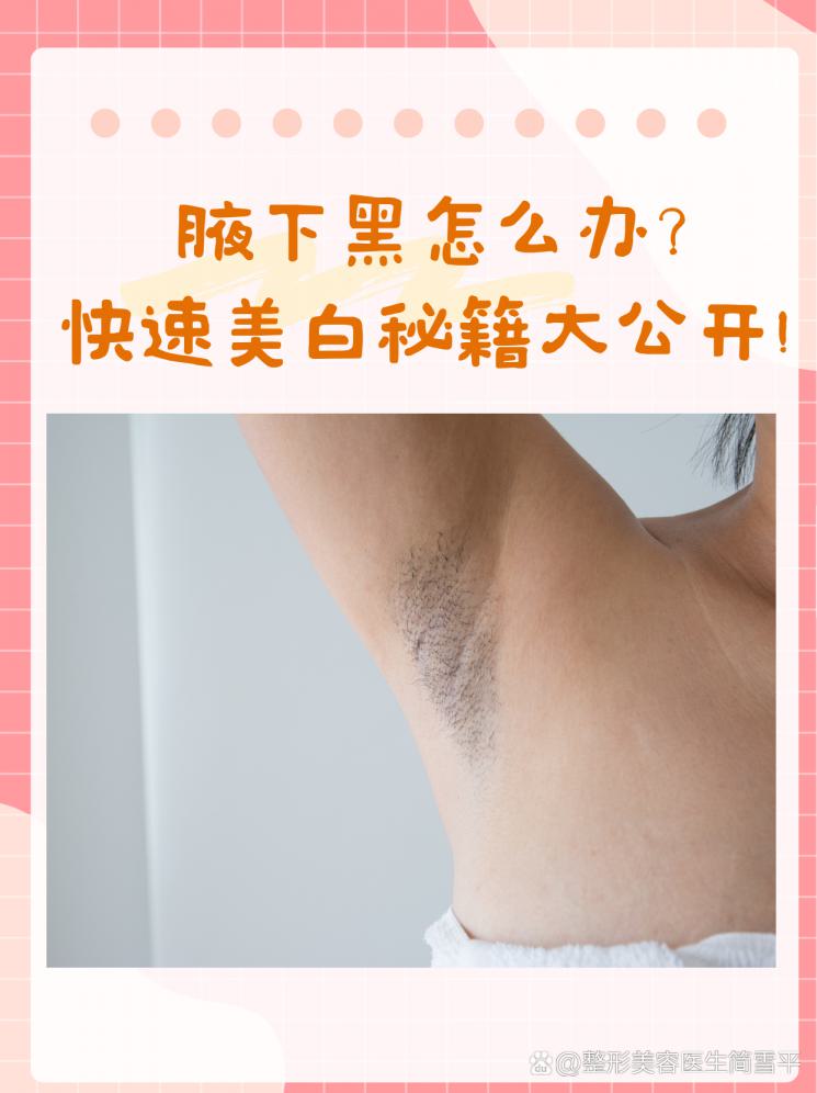 腋下黑怎么办？快速美白秘籍大公开！
