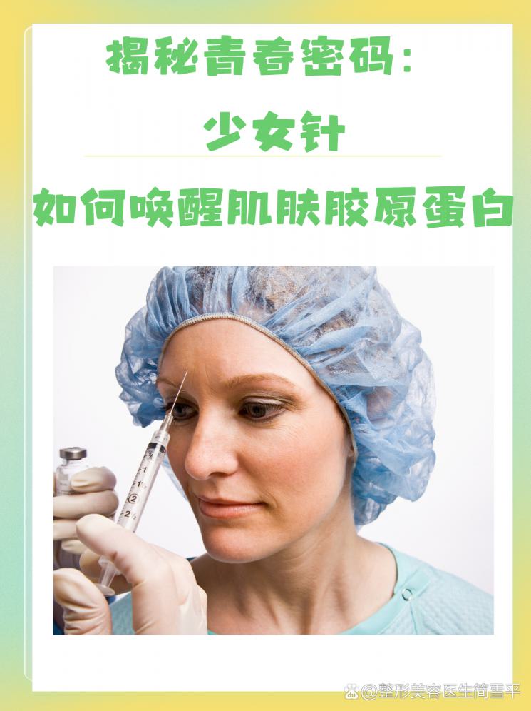 揭秘青春密码：少女针如何唤醒肌肤胶原蛋白