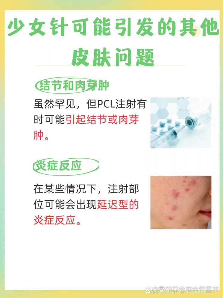 揭秘青春密码：少女针如何唤醒肌肤胶原蛋白