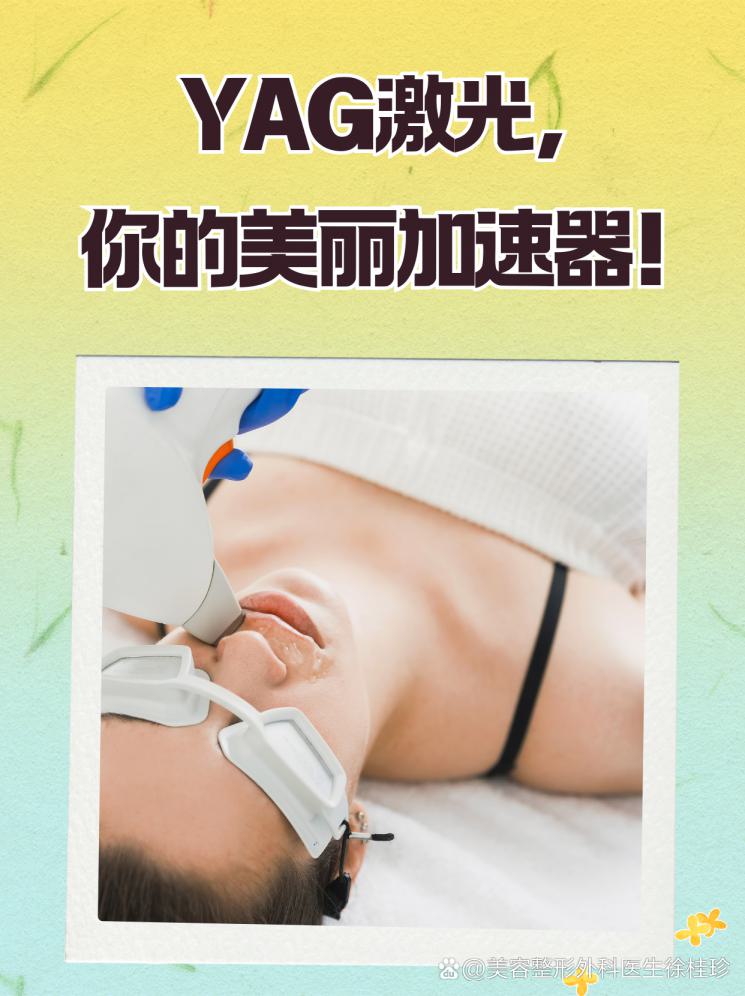 YAG激光，你的美丽加速器！