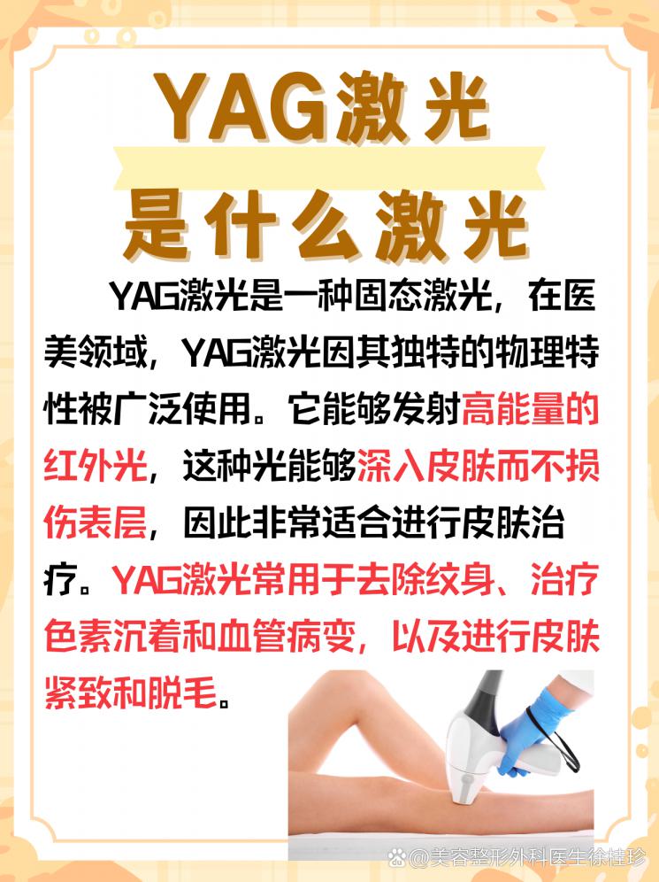 YAG激光，你的美丽加速器！