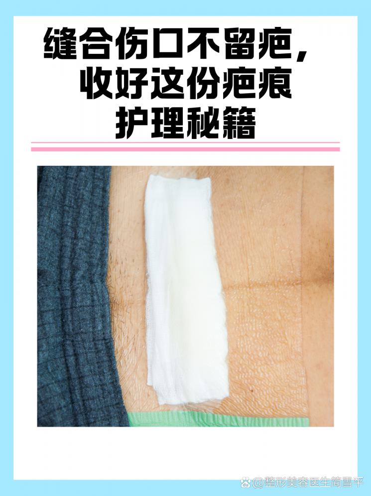 缝合伤口不留疤，收好这份疤痕护理秘籍