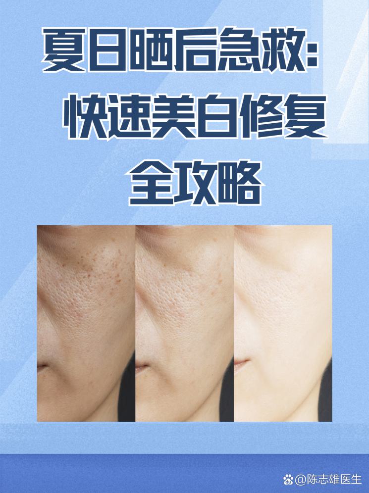 夏日晒后急救：快速美白修复全攻略