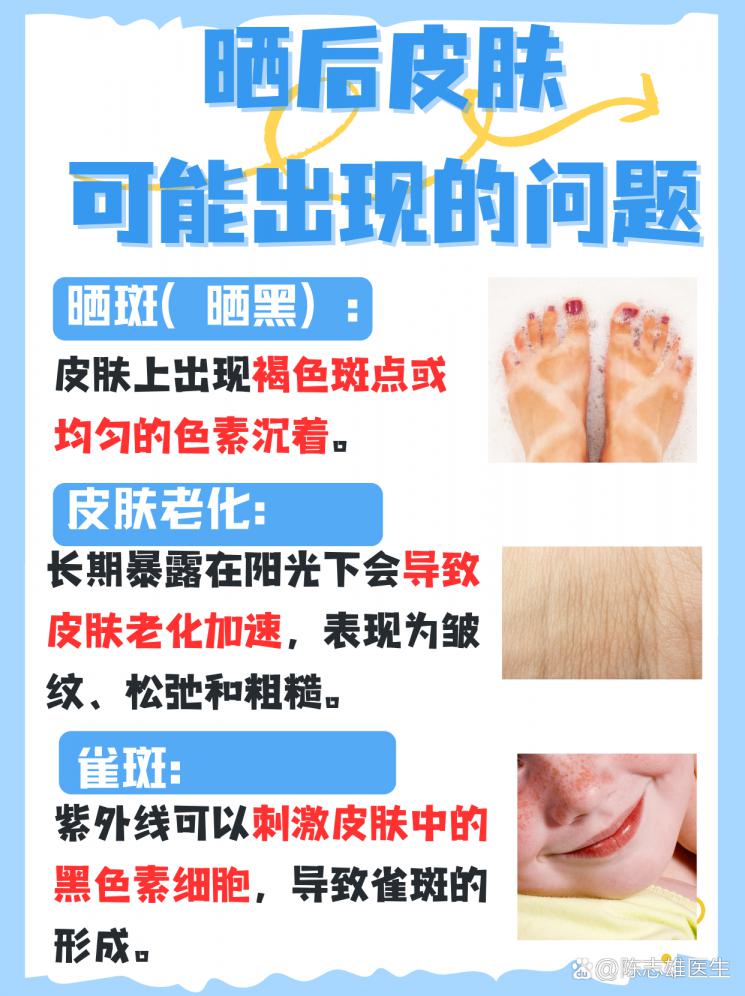 夏日晒后急救：快速美白修复全攻略