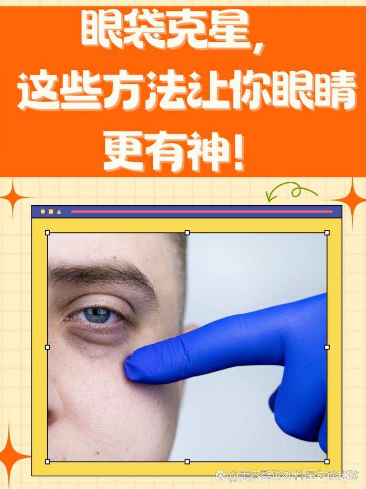 眼袋克星，这些方法让你眼睛更有神！