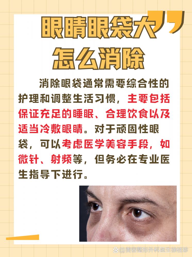 眼袋克星，这些方法让你眼睛更有神！