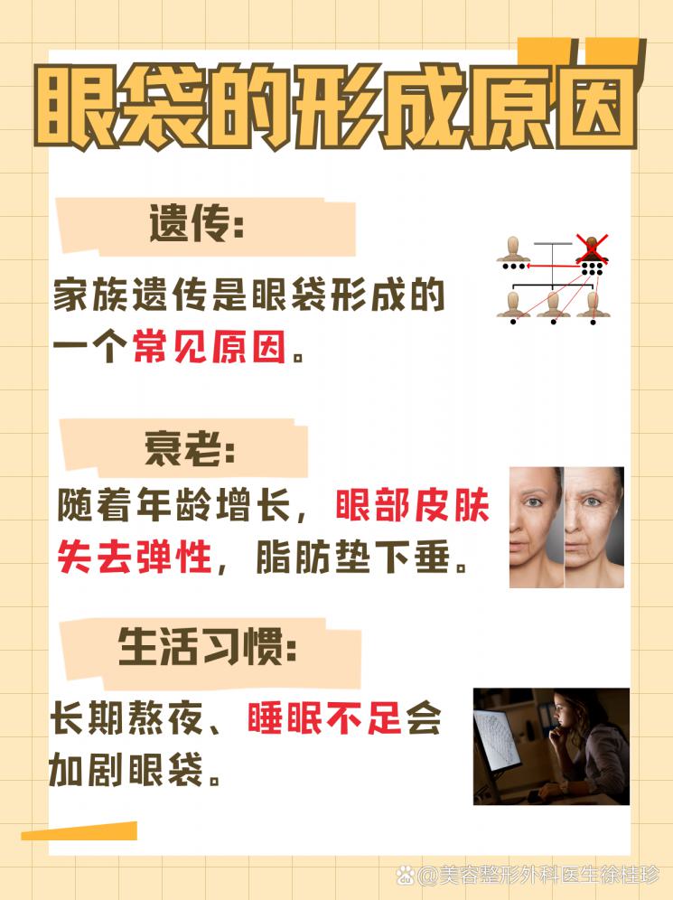 眼袋克星，这些方法让你眼睛更有神！