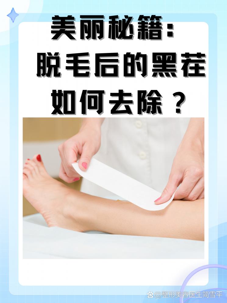 美丽秘籍：脱毛后的黑茬如何去除？
