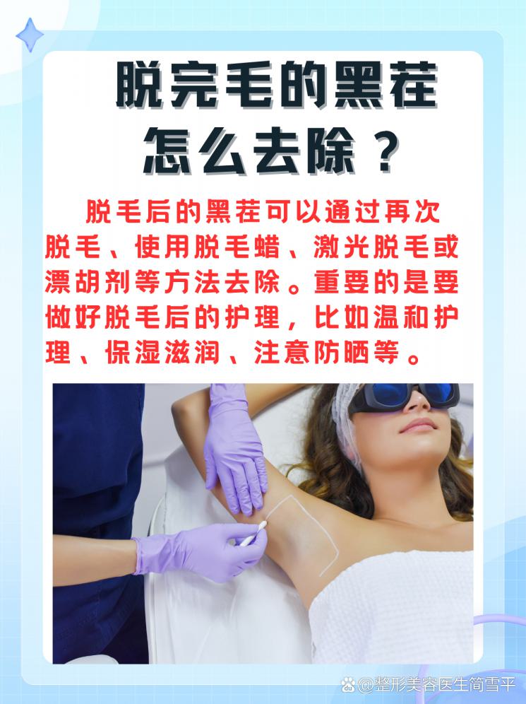 美丽秘籍：脱毛后的黑茬如何去除？
