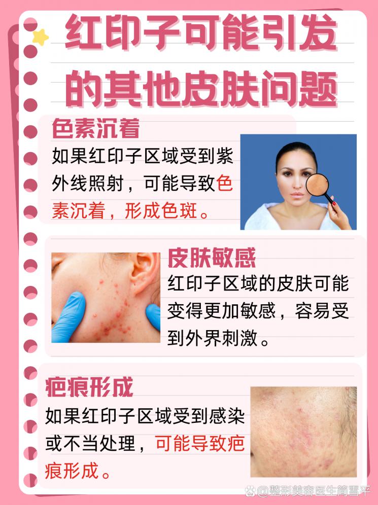 去斑后的红印子，多久能说再见？