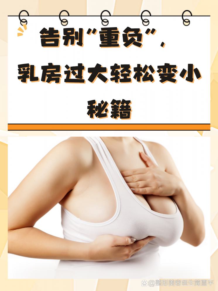 告别“重负”，乳房过大轻松变小秘籍