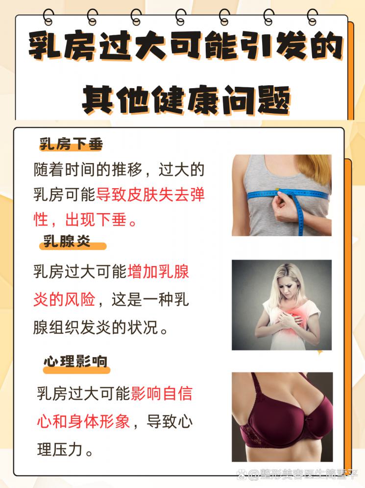 告别“重负”，乳房过大轻松变小秘籍