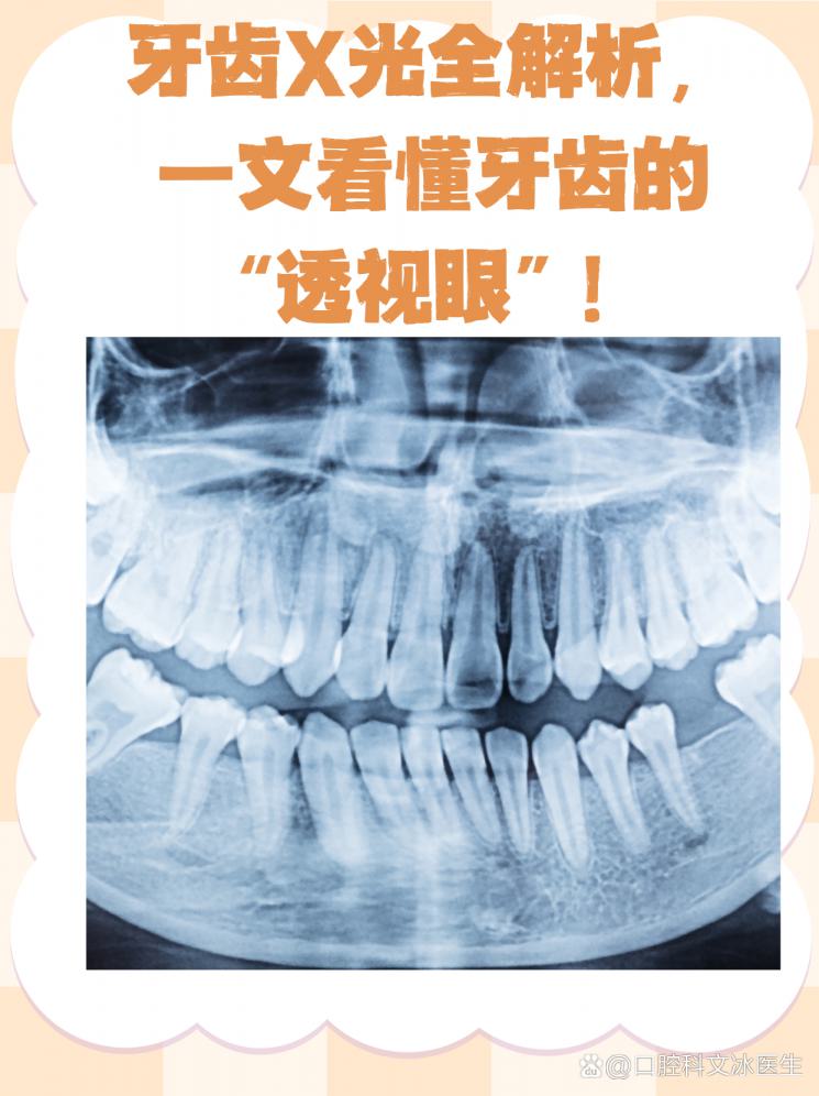 牙齿X光全解析，一文看懂牙齿的“透视眼”！