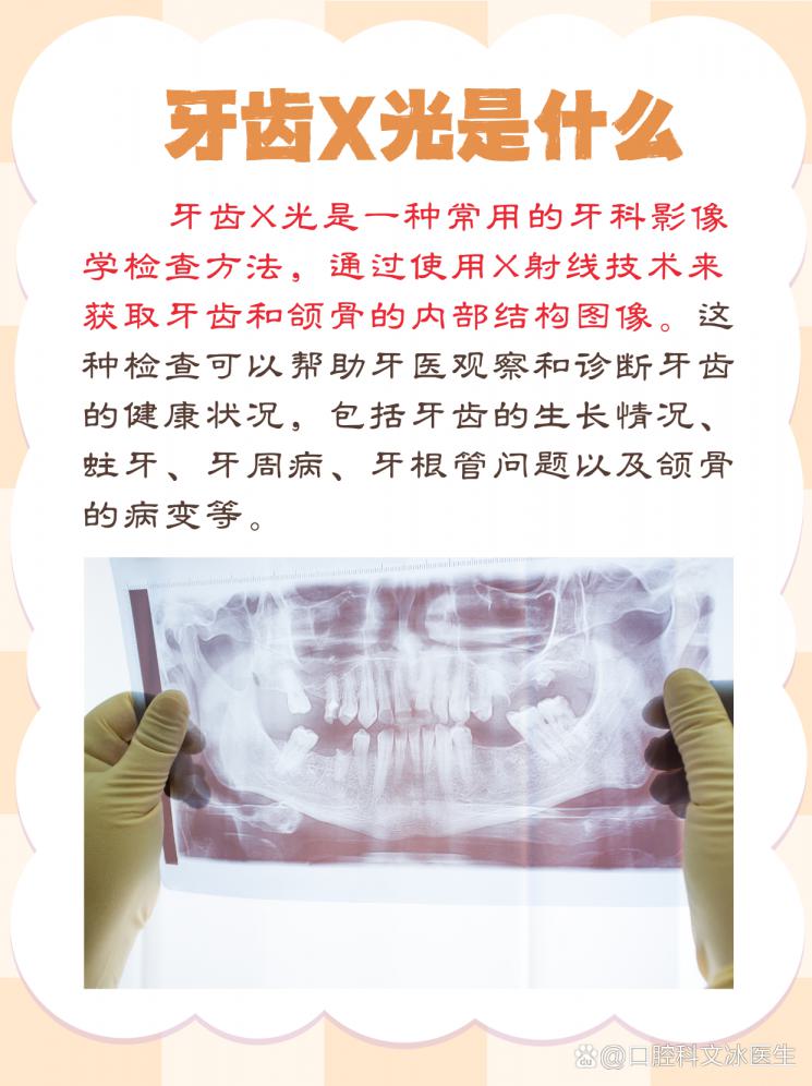 牙齿X光全解析，一文看懂牙齿的“透视眼”！