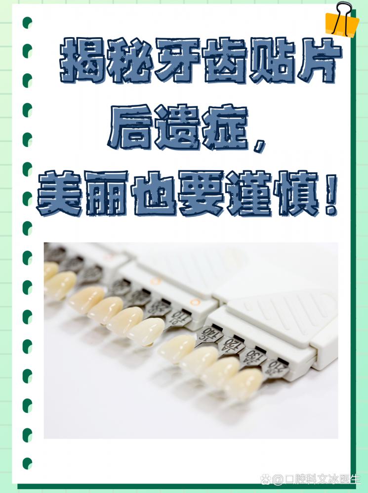 揭秘牙齿贴片后遗症，美丽也要谨慎！