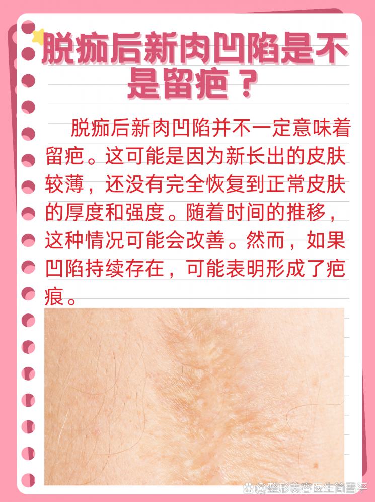 脱痂后新肉凹陷？揭秘是否为留疤！