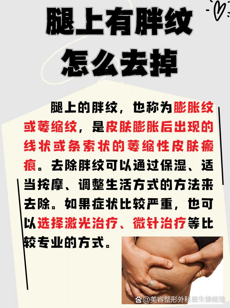 胖纹不可怕，这些方法帮你轻松抹平！
