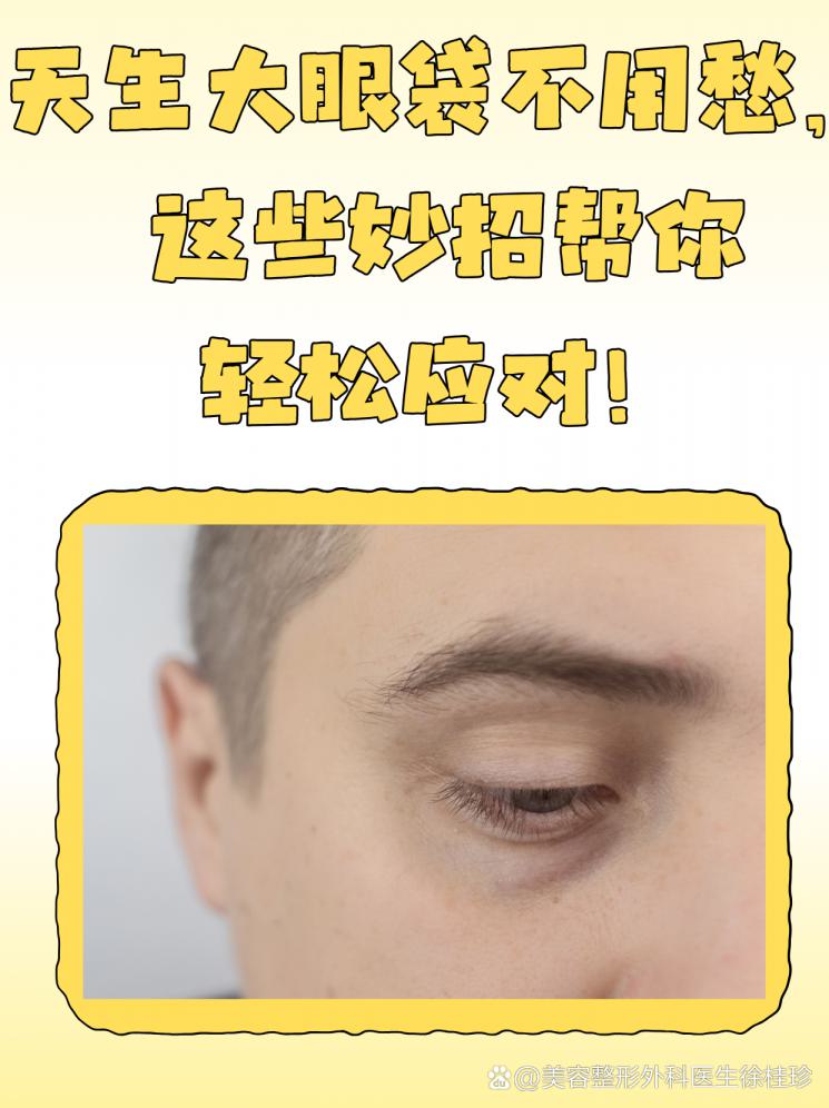 天生大眼袋不用愁，这些妙招帮你轻松应对！