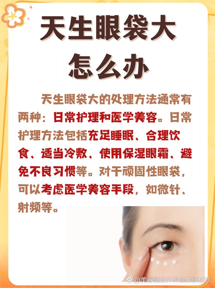 天生大眼袋不用愁，这些妙招帮你轻松应对！