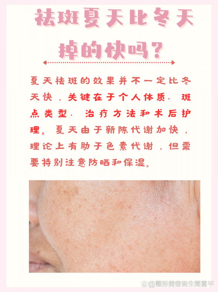 夏天祛斑，效果真的比冬天快吗？真相揭秘！