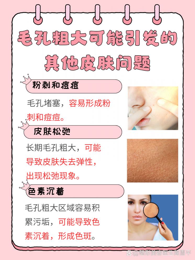 毛孔粗大怎么破？教你几招轻松搞定