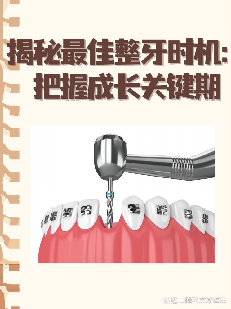 揭秘最佳整牙时机：把握成长关键期