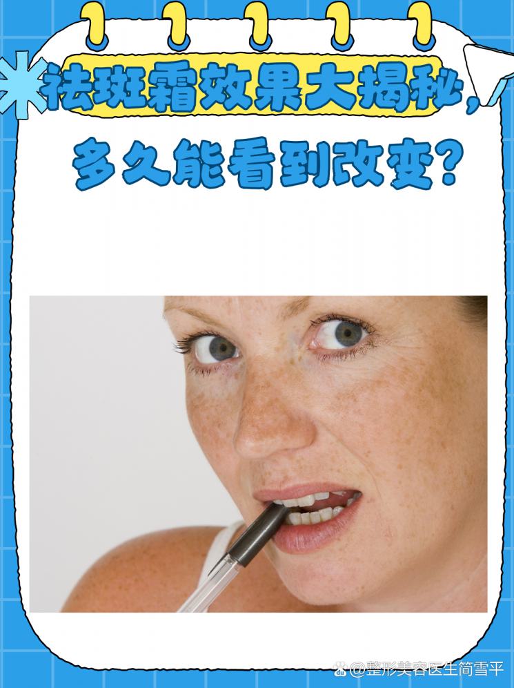 祛斑霜效果大揭秘，多久能看到改变？