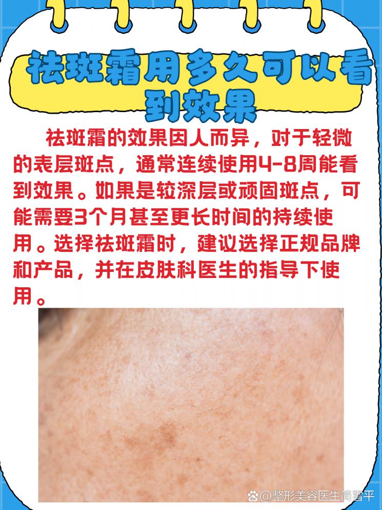 祛斑霜效果大揭秘，多久能看到改变？