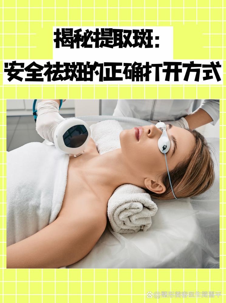 揭秘提取斑：安全祛斑的正确打开方式