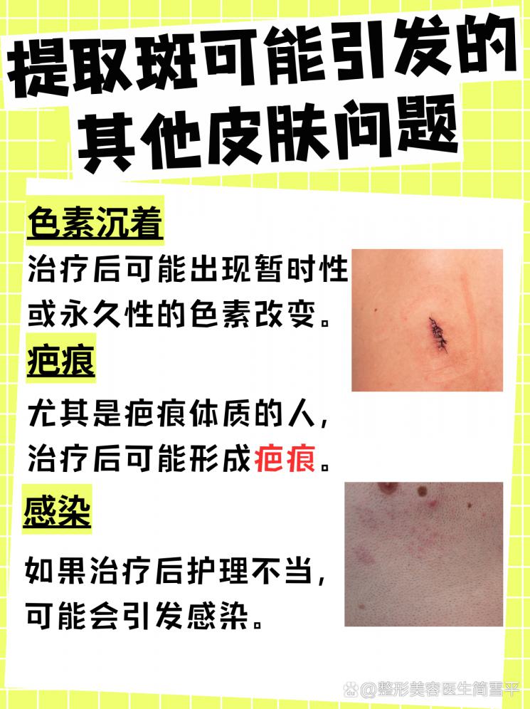 揭秘提取斑：安全祛斑的正确打开方式