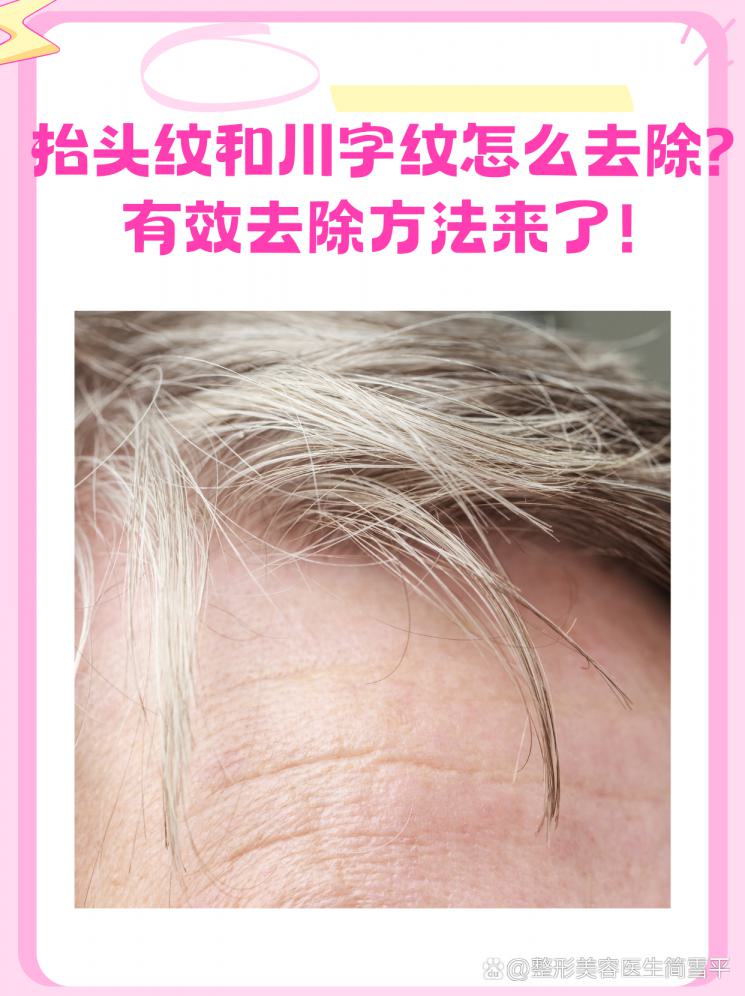 抬头纹和川字纹怎么去除？有效去除方法来了！