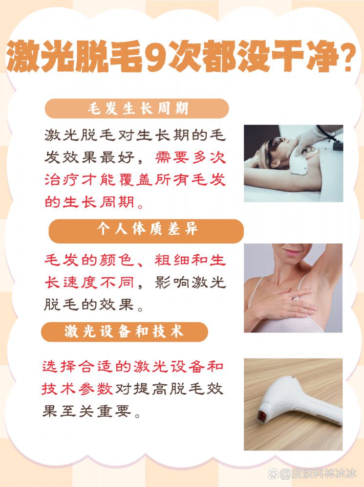 激光脱毛9次仍无效？揭秘背后真相