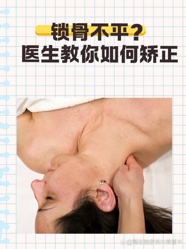 锁骨不平？医生教你如何矫正