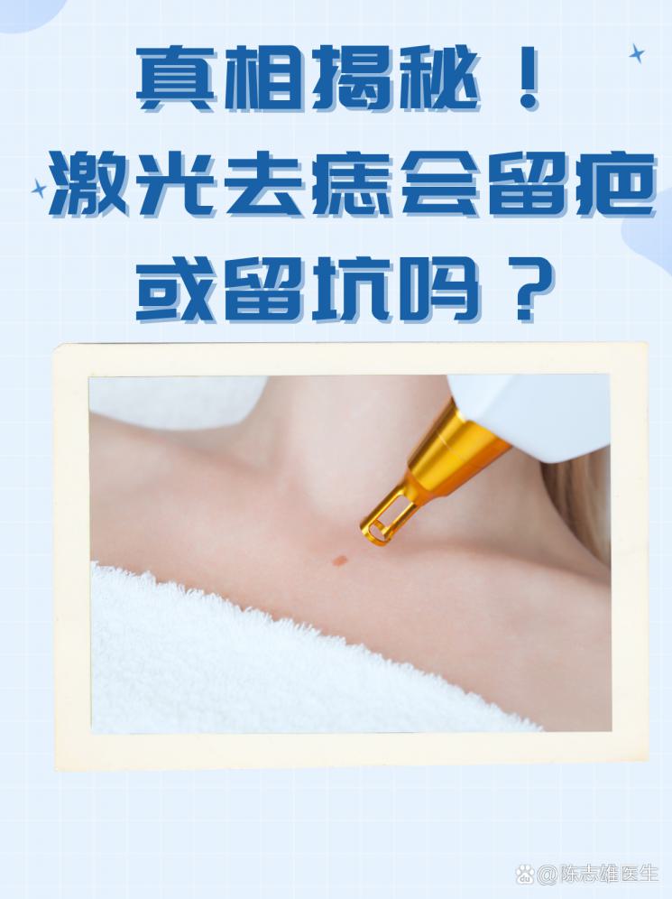 真相揭秘！激光去痣会留疤或留坑吗？