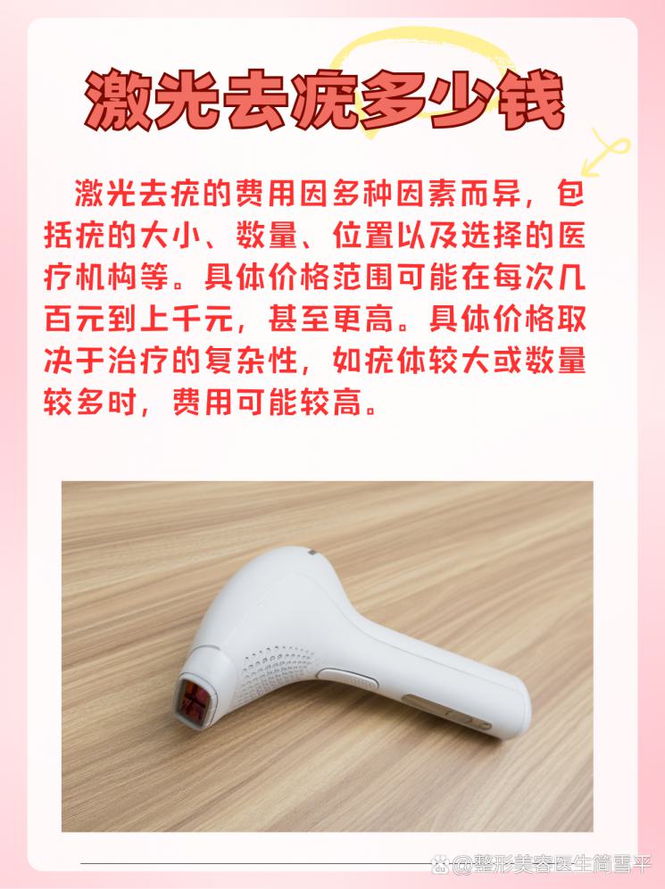 激光去疣，价格大揭秘！