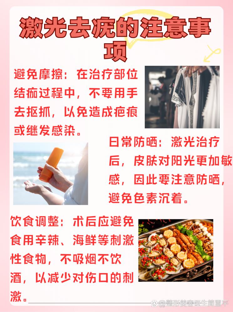 激光去疣，价格大揭秘！