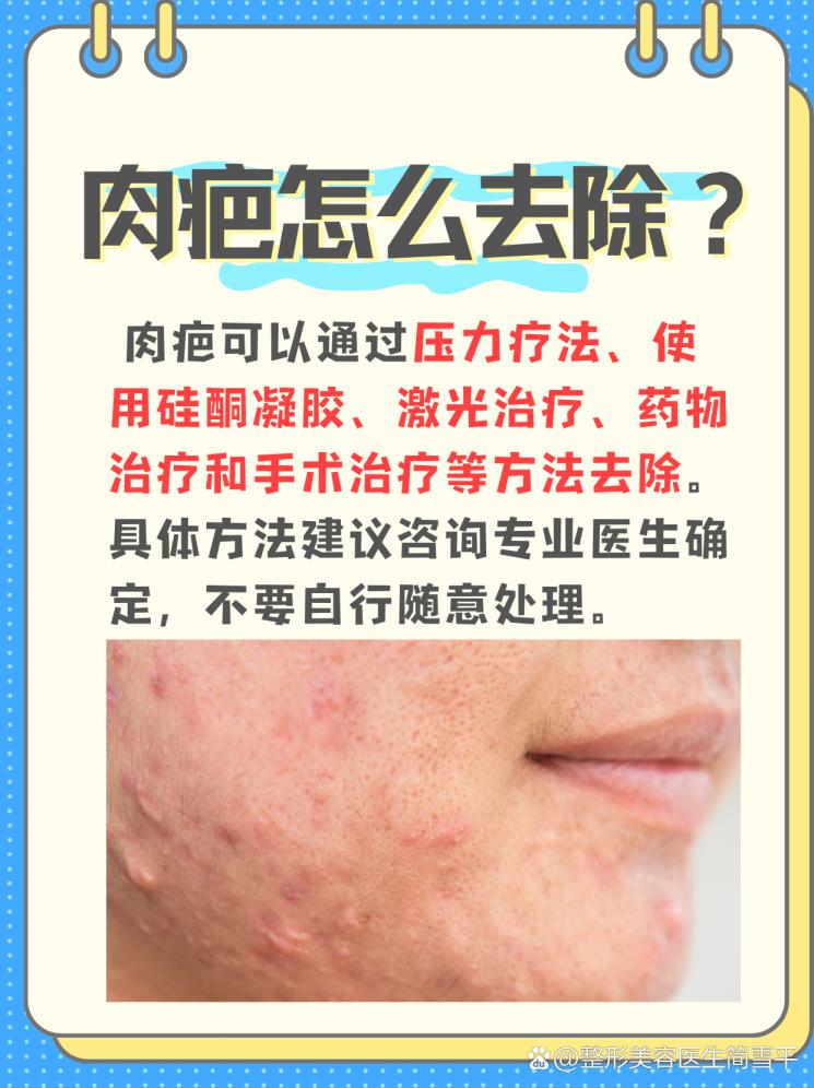 肉疤不再困扰：揭秘去除肉疤的科学方法！