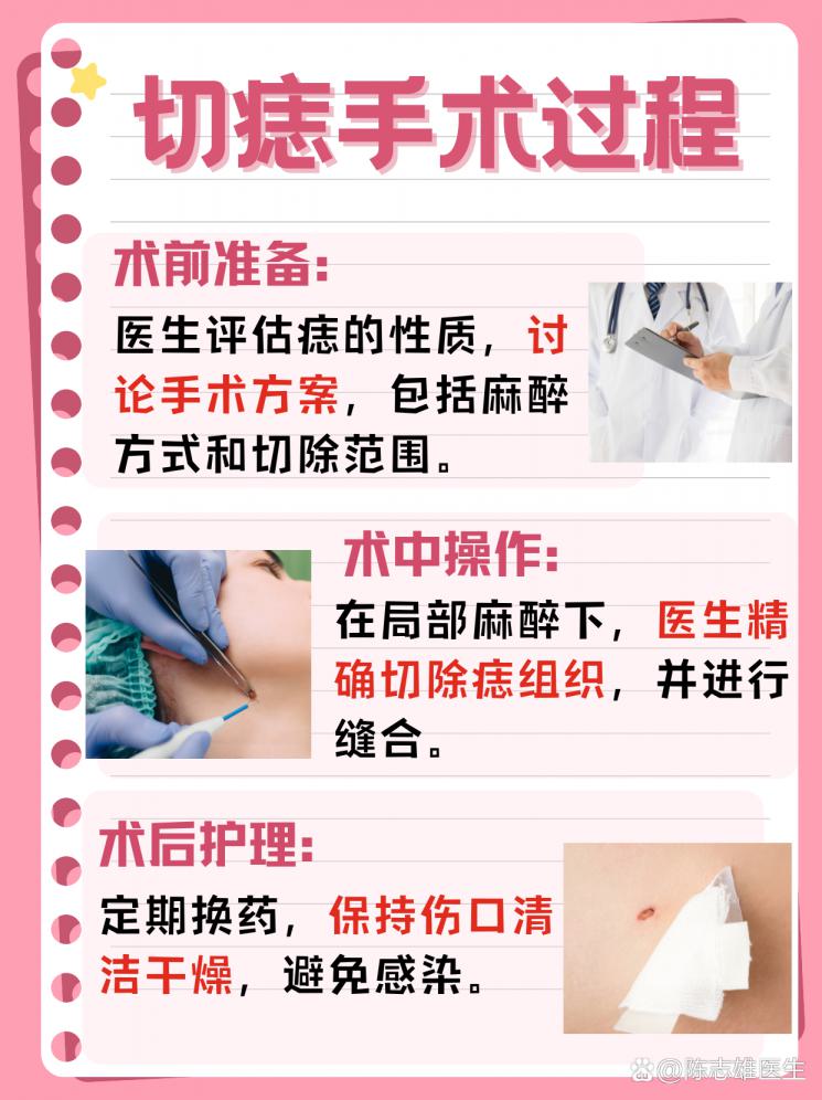 揭秘切痣手术全过程，安心变美