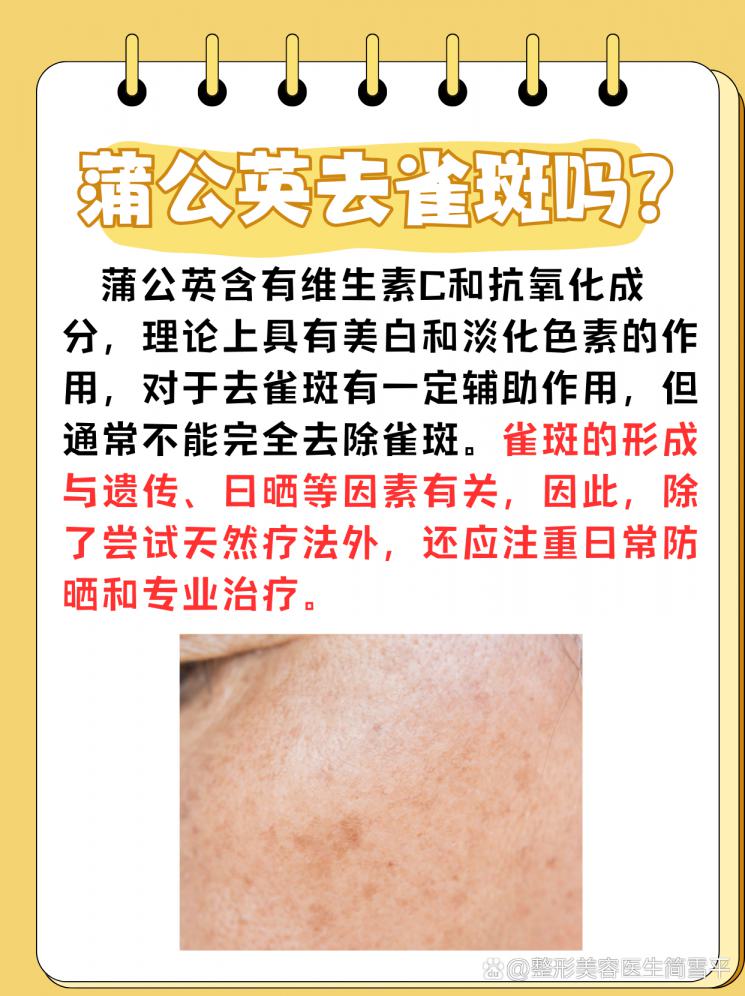 蒲公英，真的能帮你“吹”走雀斑吗？