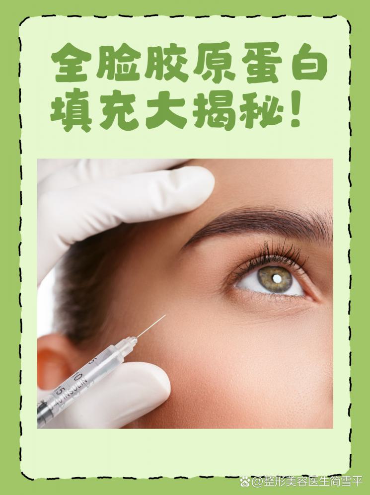 全脸胶原蛋白填充大揭秘！
