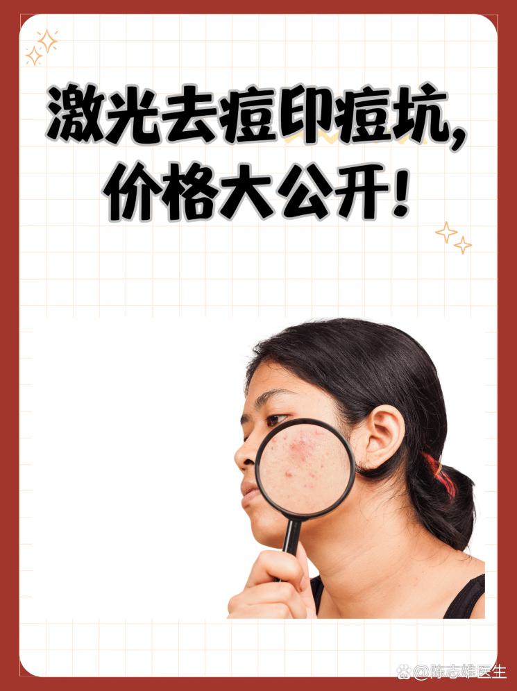 激光去痘印痘坑，价格大公开！
