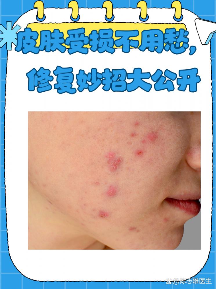 皮肤受损不用愁，修复妙招大公开