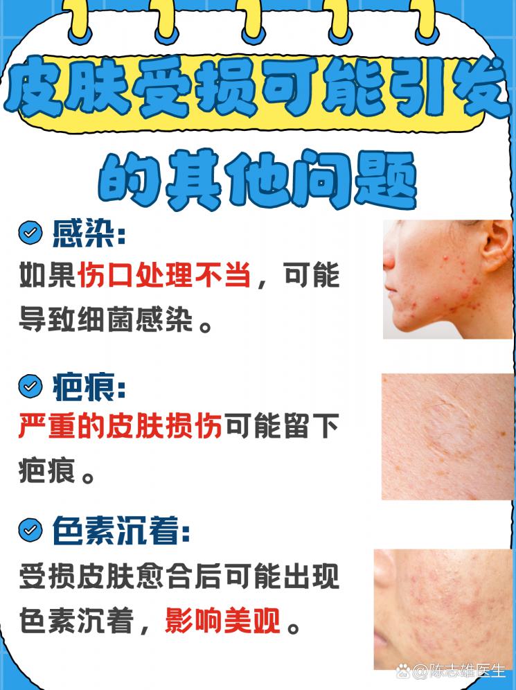 皮肤受损不用愁，修复妙招大公开