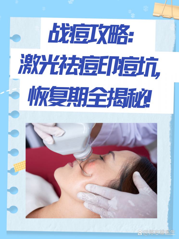 战痘攻略：激光祛痘印痘坑，恢复期全揭秘！