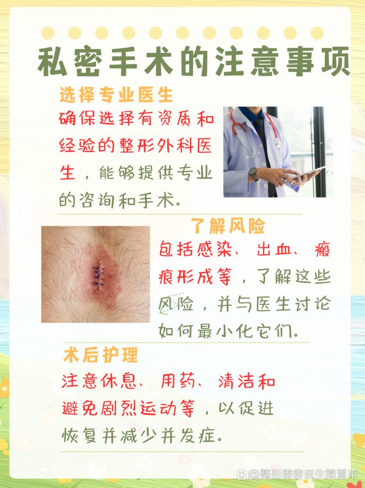 私密手术大揭秘，你知道吗？