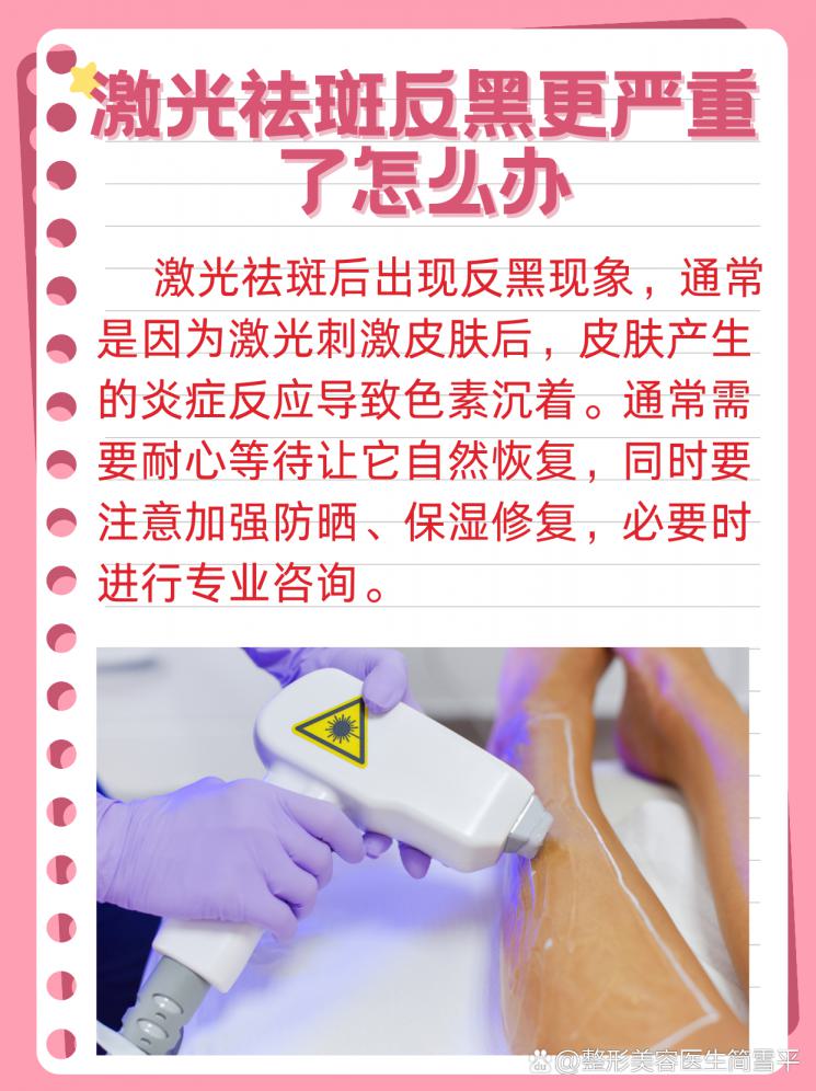 激光祛斑反黑？别慌，这里有秘方！